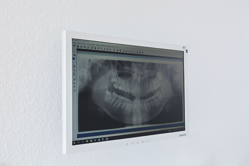 Um Zahnprobleme effizienter zu erkennen setzt Alexandra Zagwodzki in ihrer Praxis in Duisburg auf digitales Röntgen.