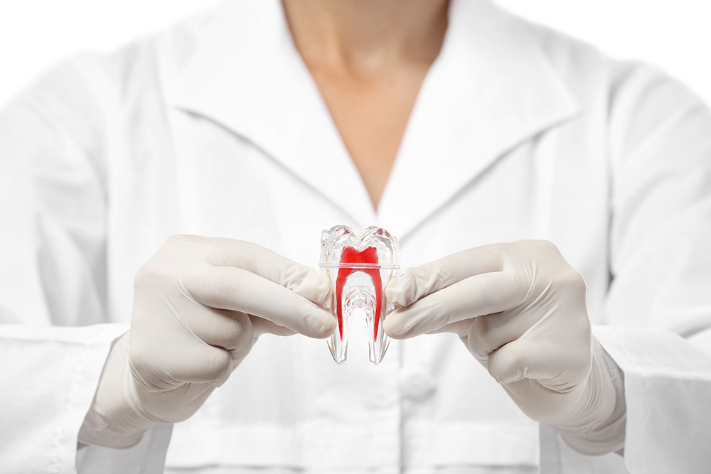 Eine Wurzelkanalbehandlung ist notwendig, um einen erkrankten Zahn dauerhaft zu erhalten.